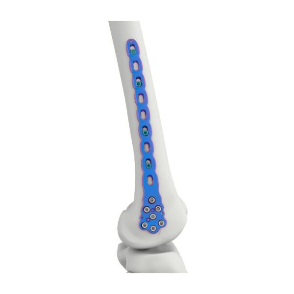 वीएल डिस्टल फेमोरल लॉकिंग प्लेट